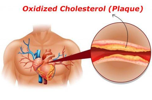 The Oxidized Cholesterol Strategy Benefits